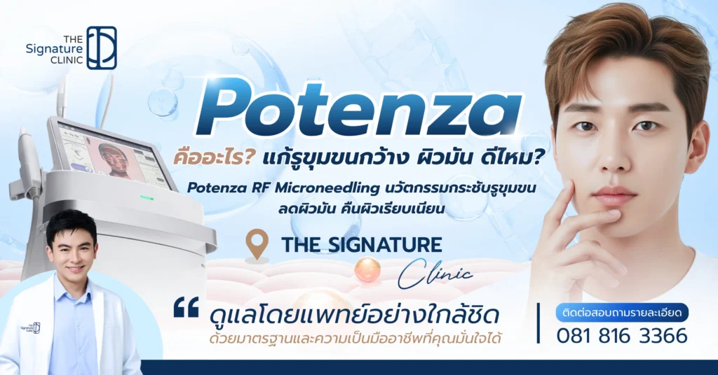 Potenza RF Microneedling 1