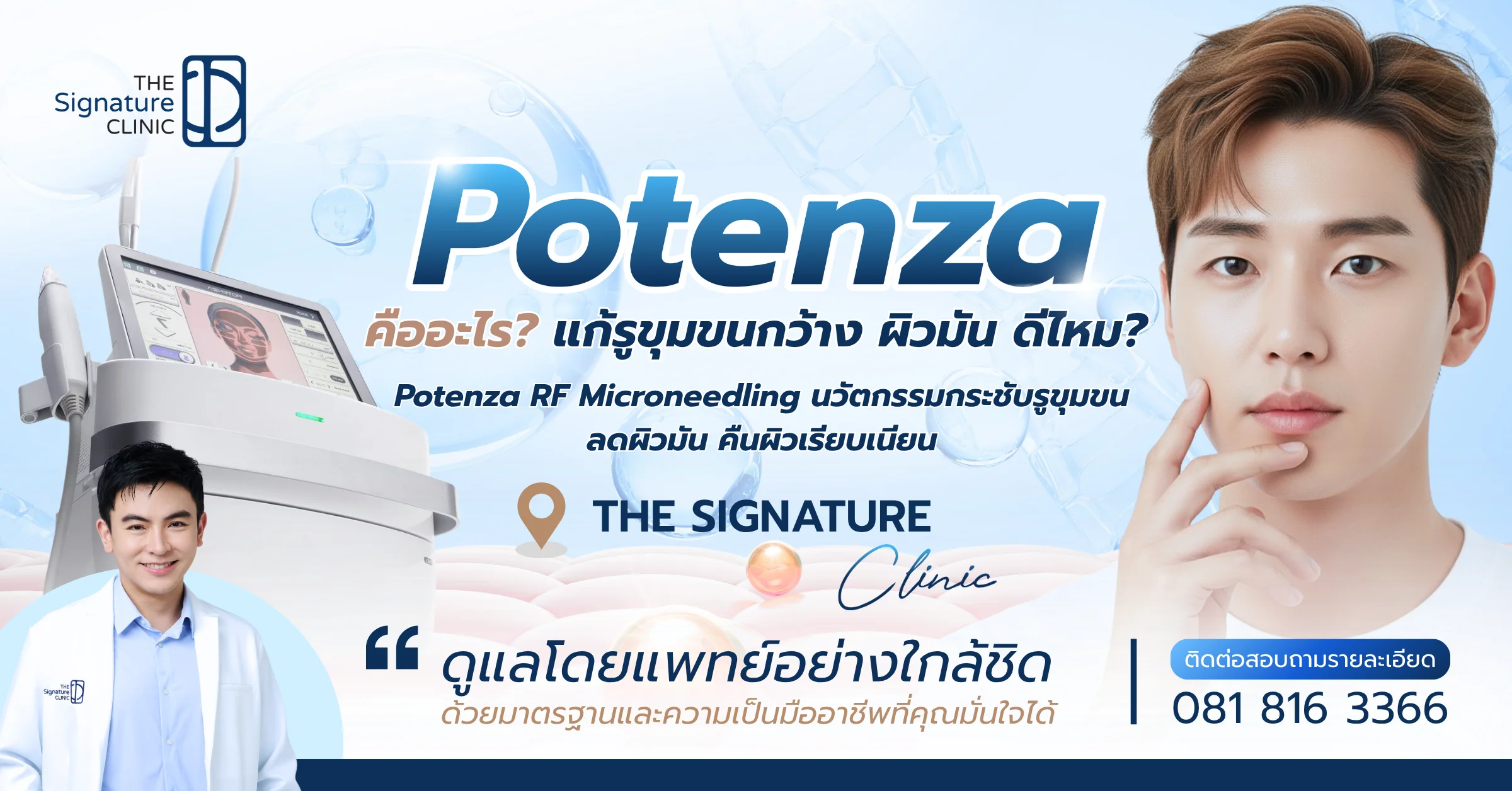 Potenza RF Microneedling 1