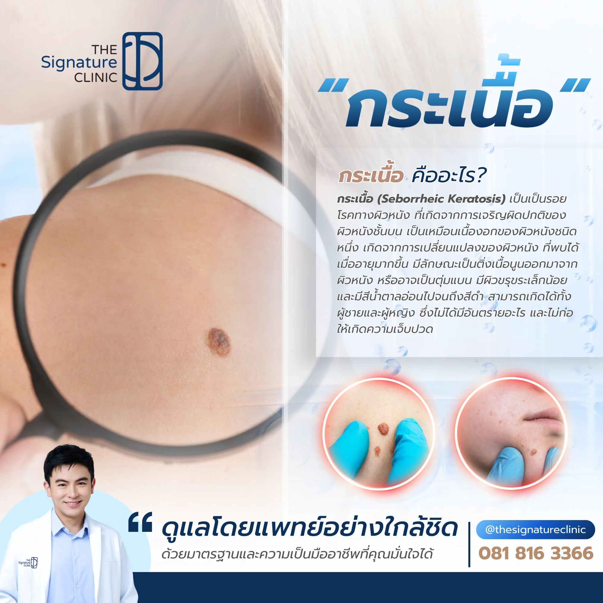 กระเนื้อ