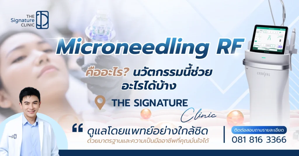 Microneedling RF 1