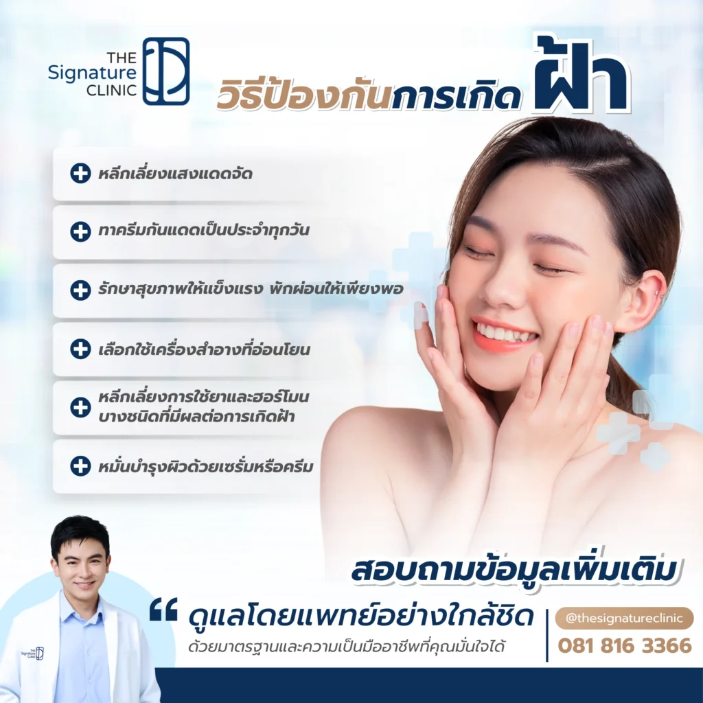 what causes melasma 3