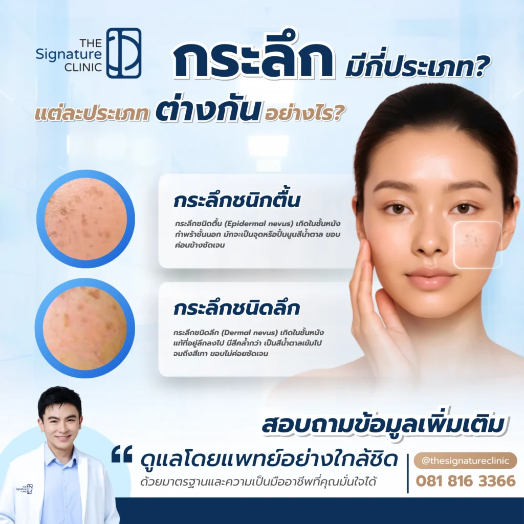 กระลึก คือ 3