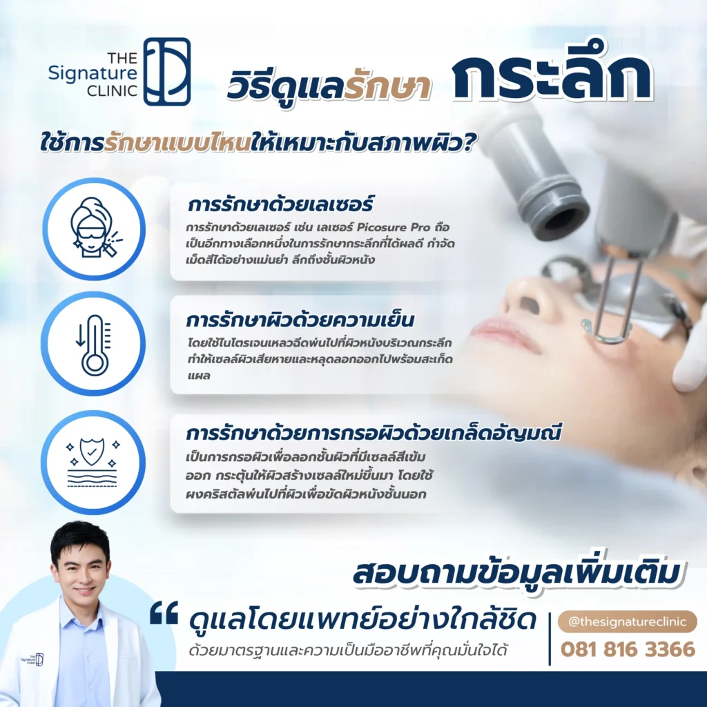 กระลึก เกิดจาก 3