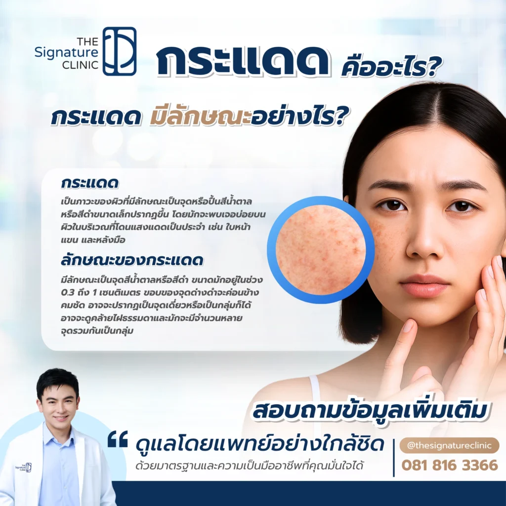 กระแดด 2