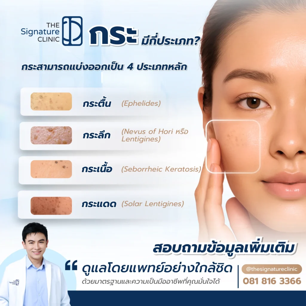 ผิวเป็นกระ 3