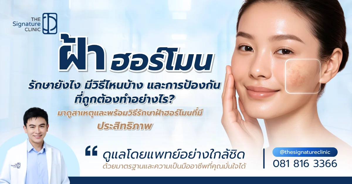 ฝ้าฮอร์โมน รักษายังไง 1