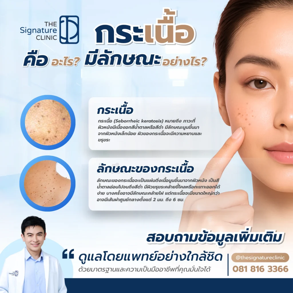 รักษากระเนื้อ 2