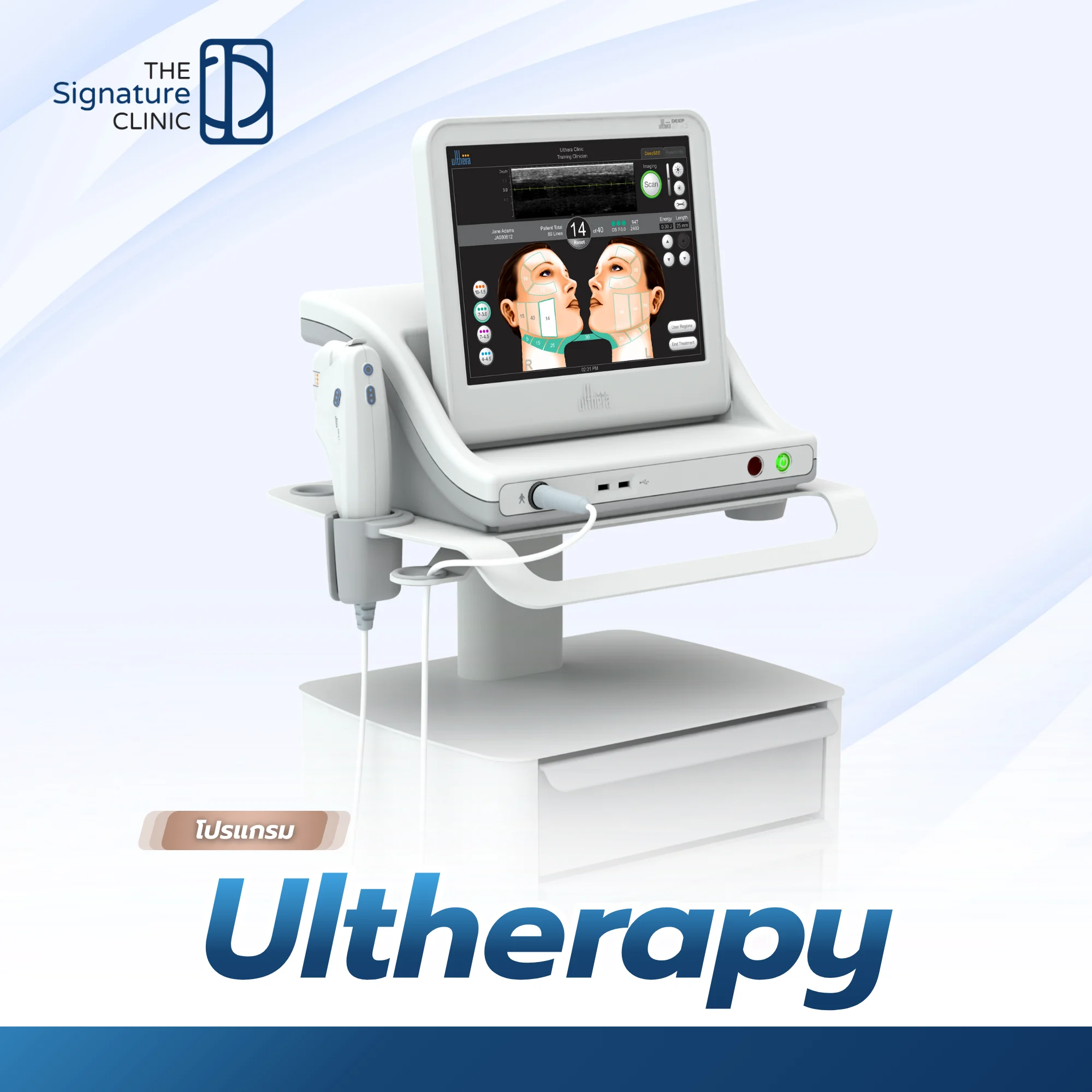 Ultherapy 5