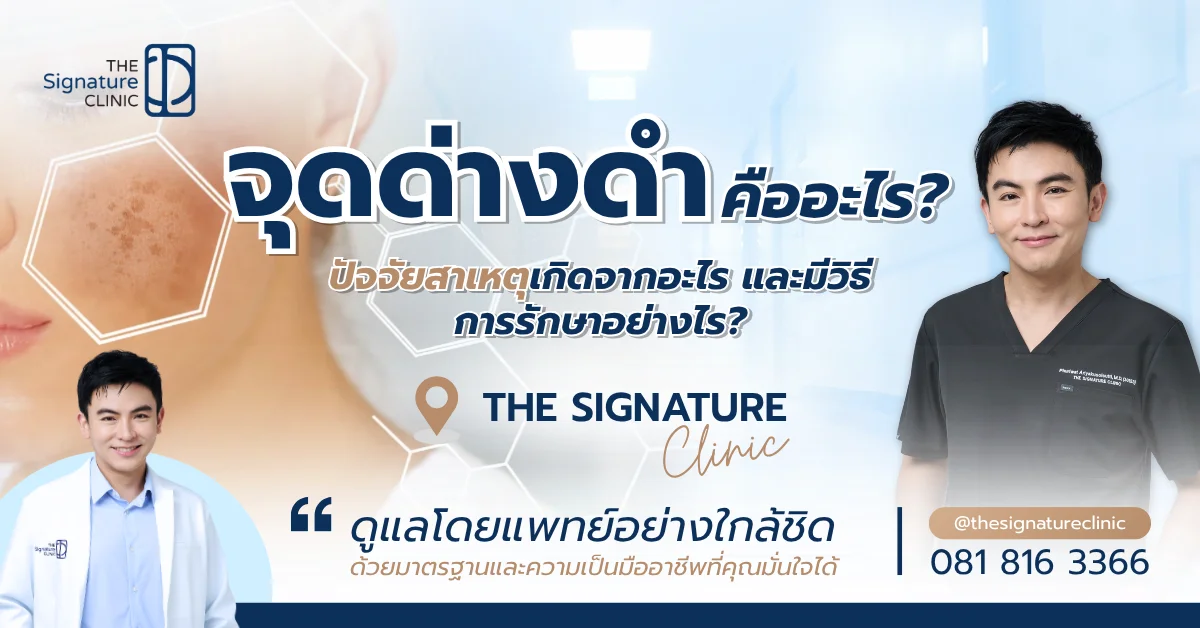 จุดด่างดำ 1