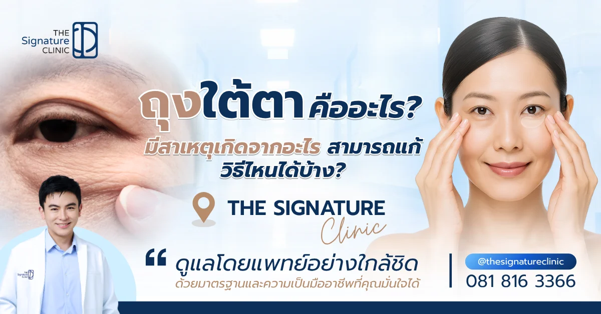 ถุงใต้ตา 1