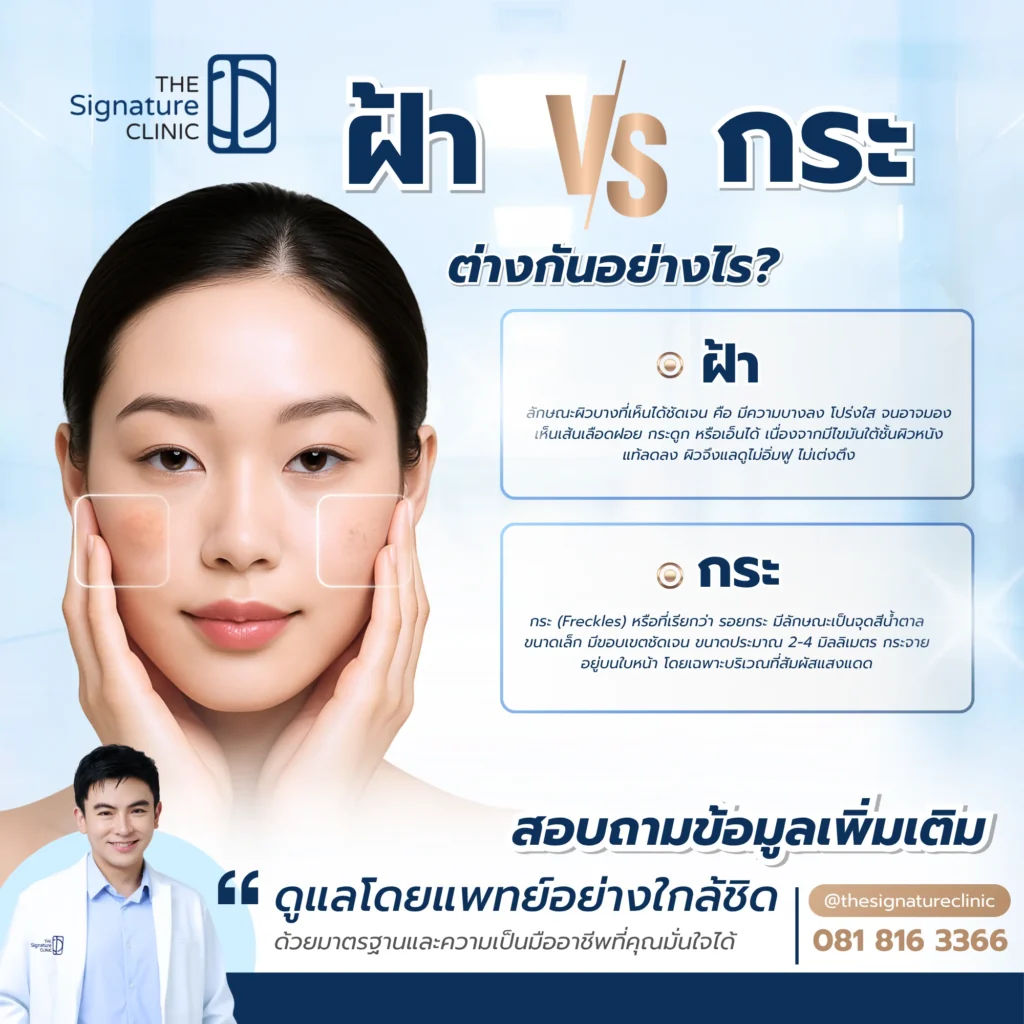 ฝ้า กระ ต่างกันอย่างไร 2