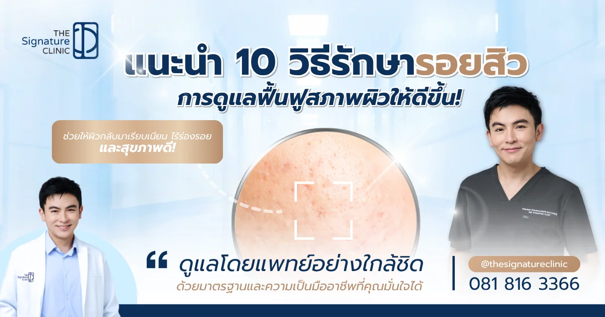 รอยสิว 1