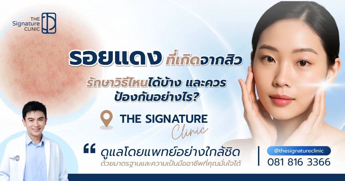 รอยแดง 1