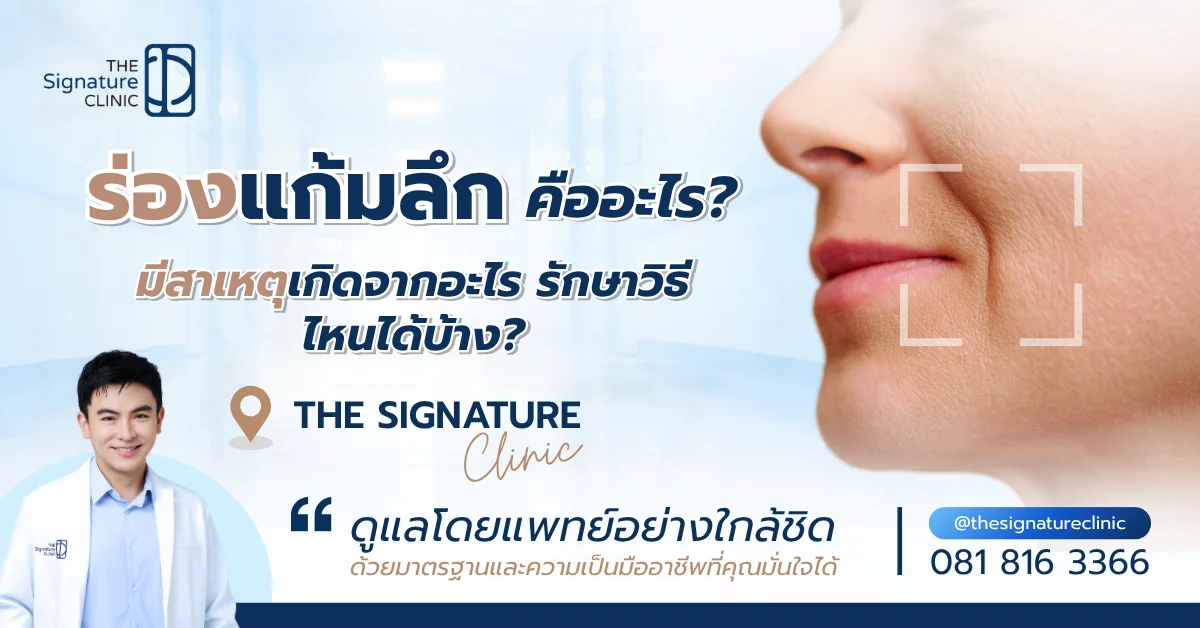 ร่องแก้มลึก 1