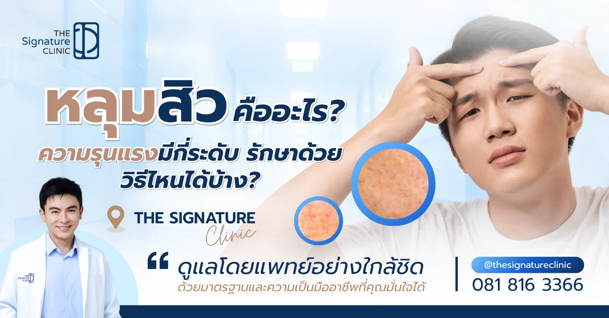 หลุมสิว