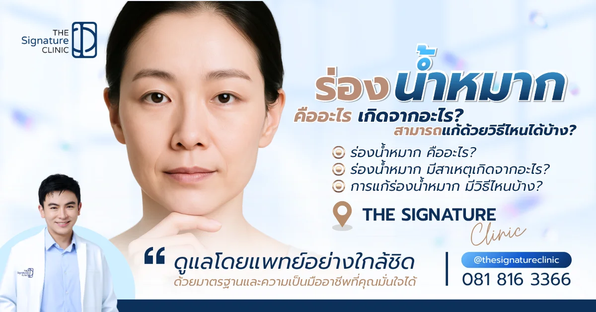 ร่องน้ำหมาก