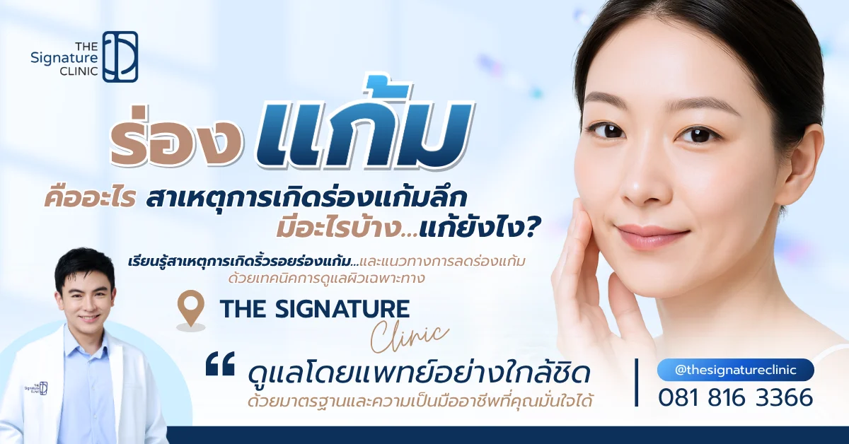 ร่องแก้ม