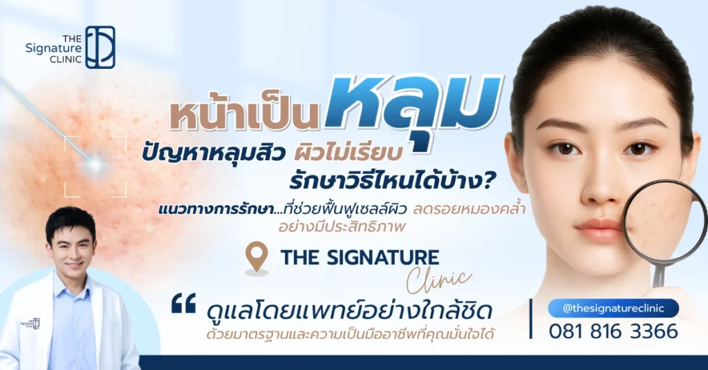 หน้าเป้นหลุม