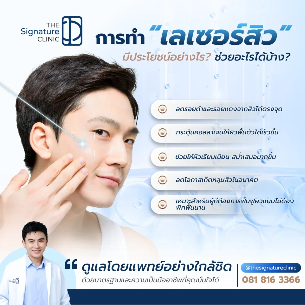 เลเซอร์รอยสิว