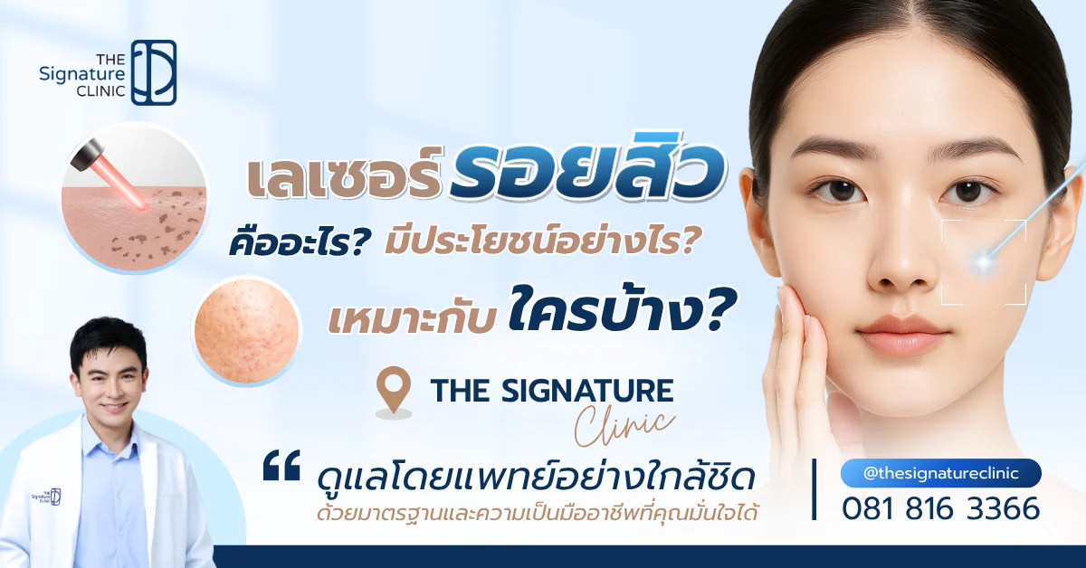 เลเซอร์รอยสิว