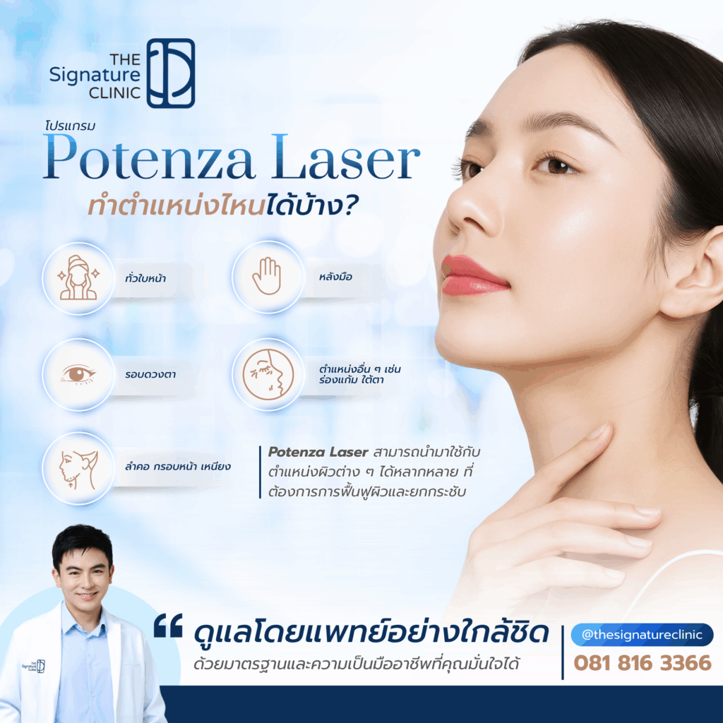 Potenza Laser