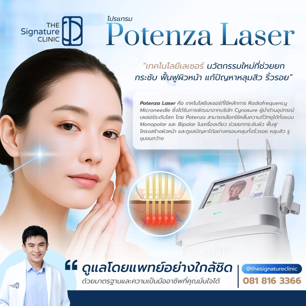 Potenza Laser
