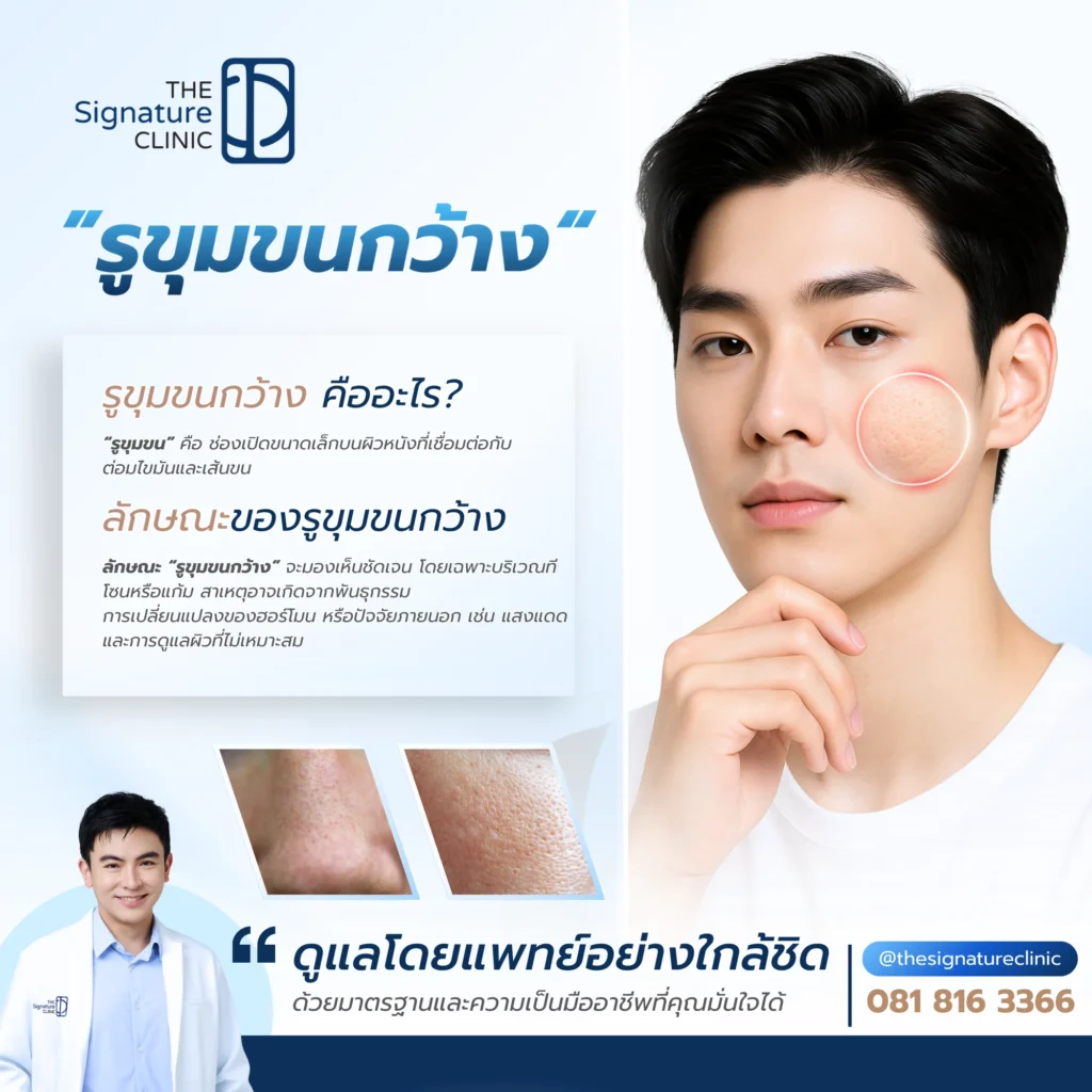 กระชับรูขุมขน