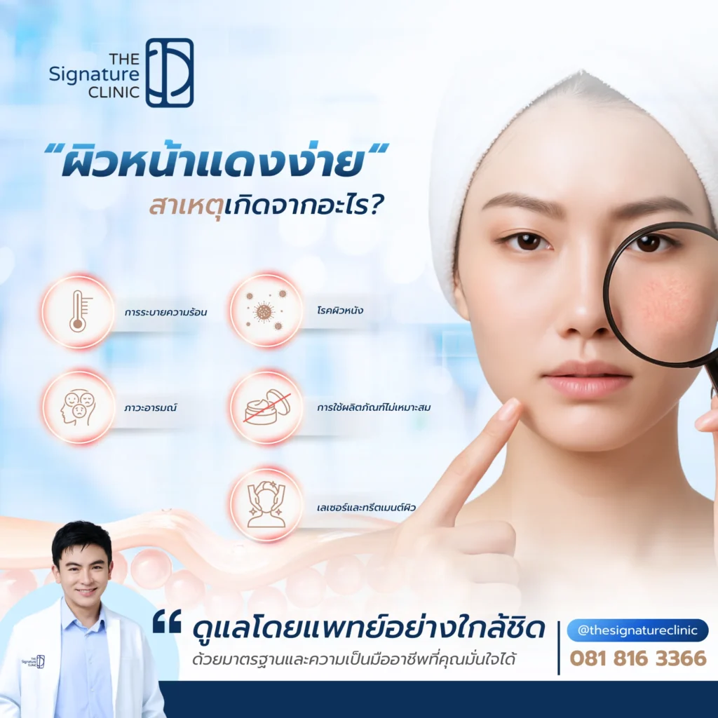 ผิวหน้าแดง