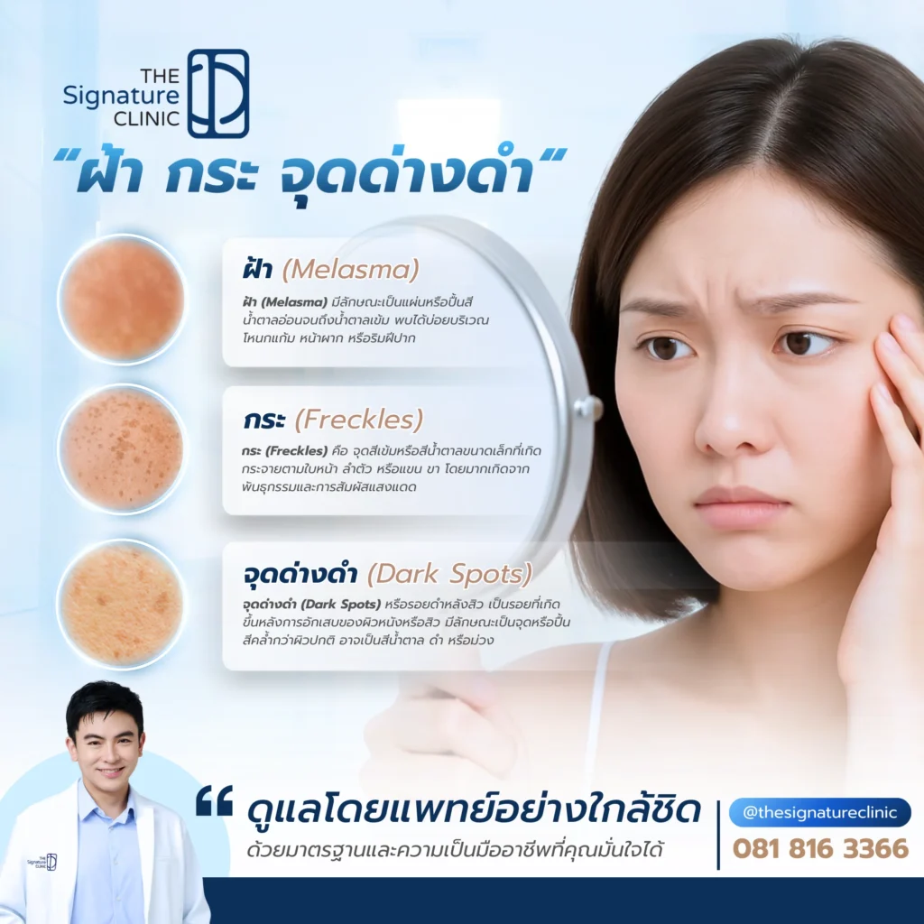 ฝ้า กระ จุดด่างดํา