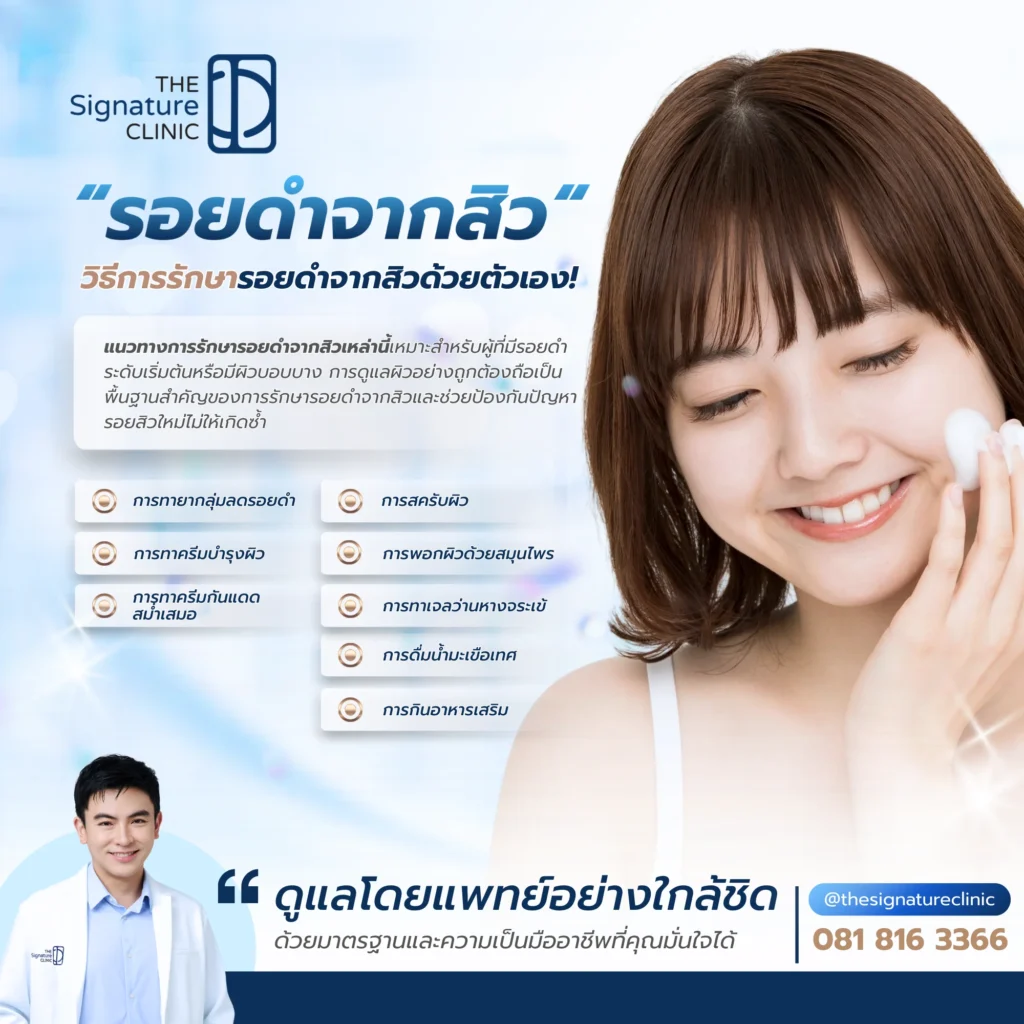 รอยดำจากสิว