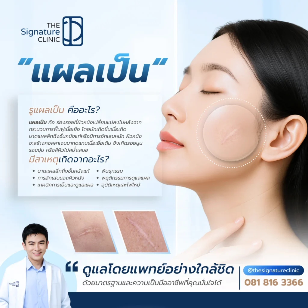 รักษาแผลเป็น