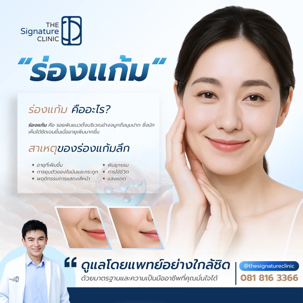 ลดร่องแก้ม