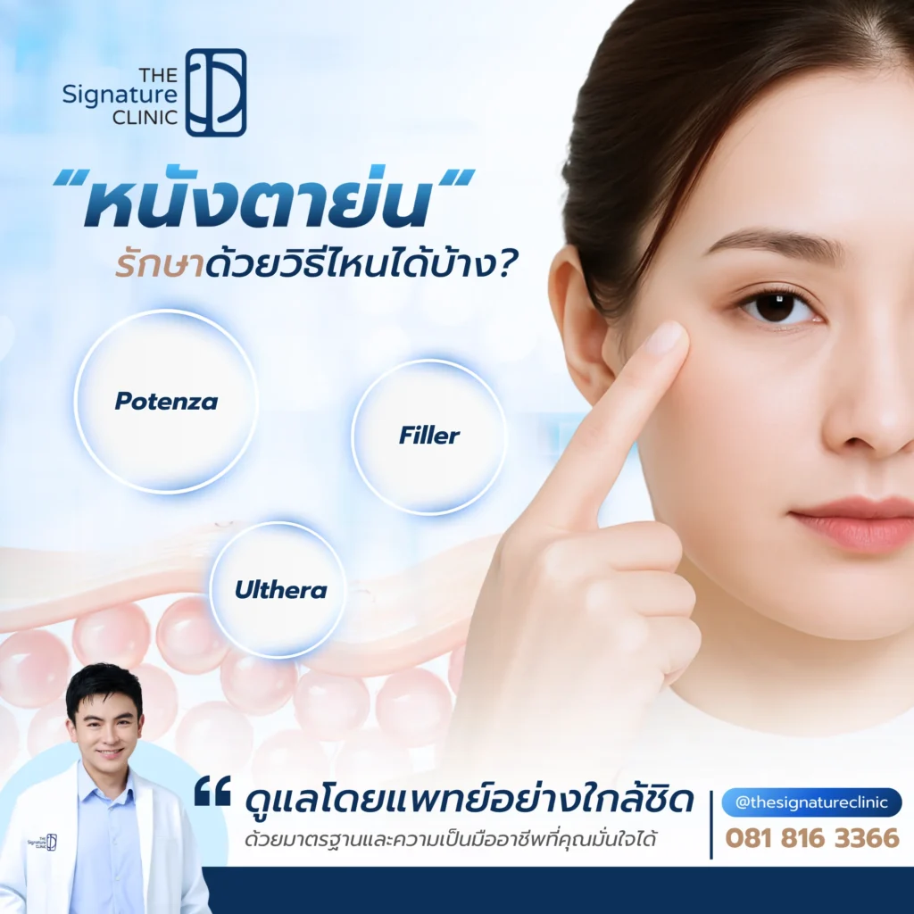 หนังตาย่น