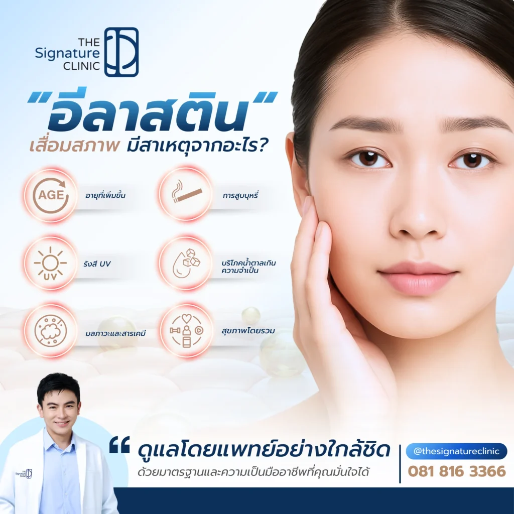 อีลาสติน