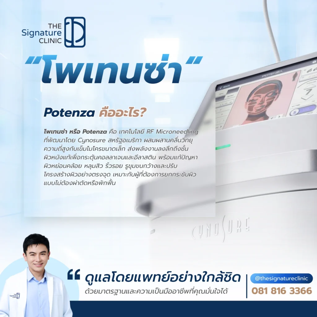 โพเทนซ่า