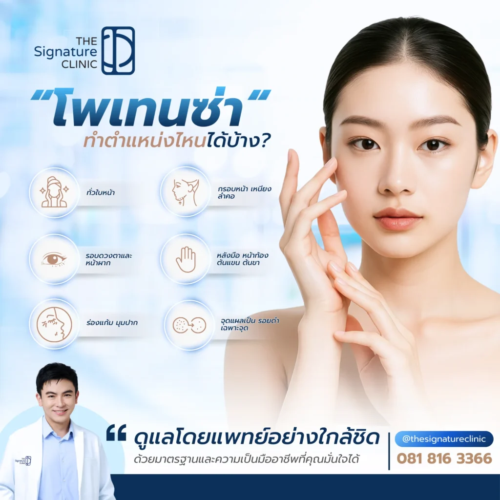 โพเทนซ่า