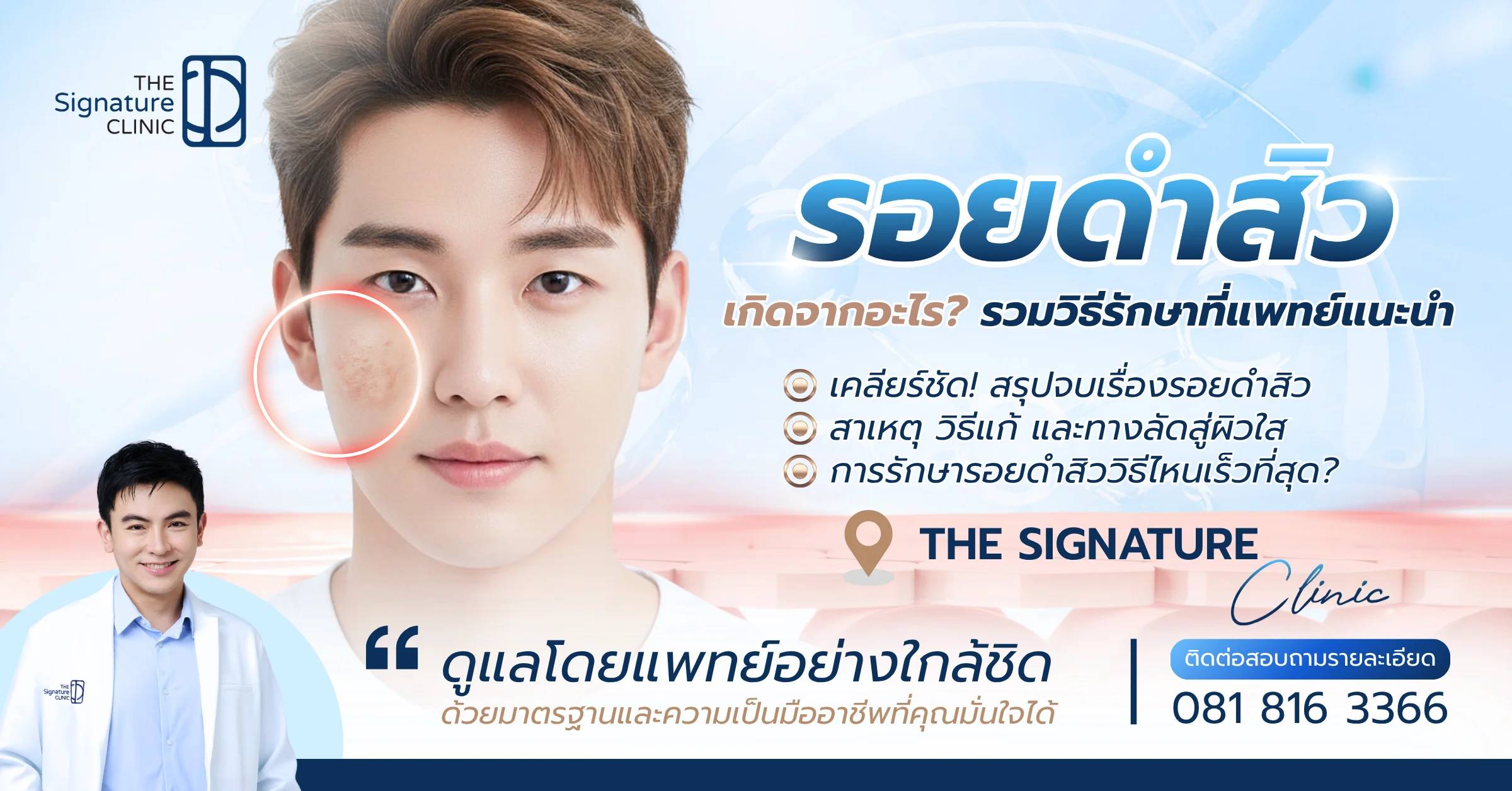 รอยดำสิว