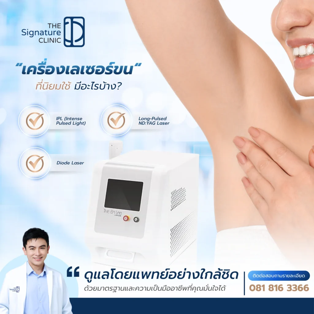 เลเซอร์กำจัดขน