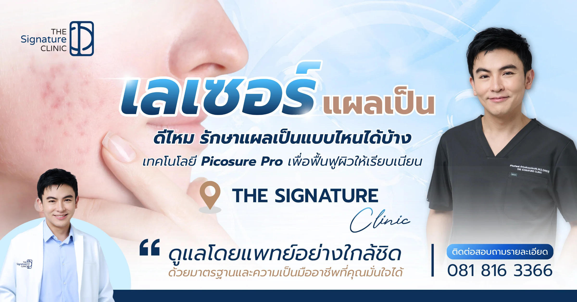 เลเซอร์แผลเป็น