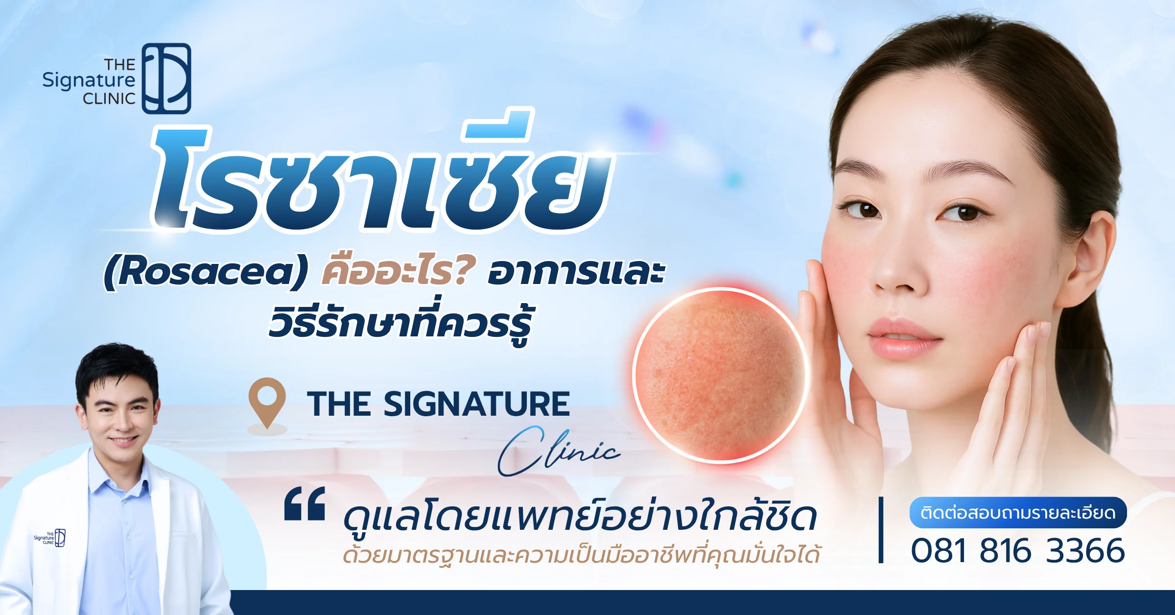 โรซาเซีย