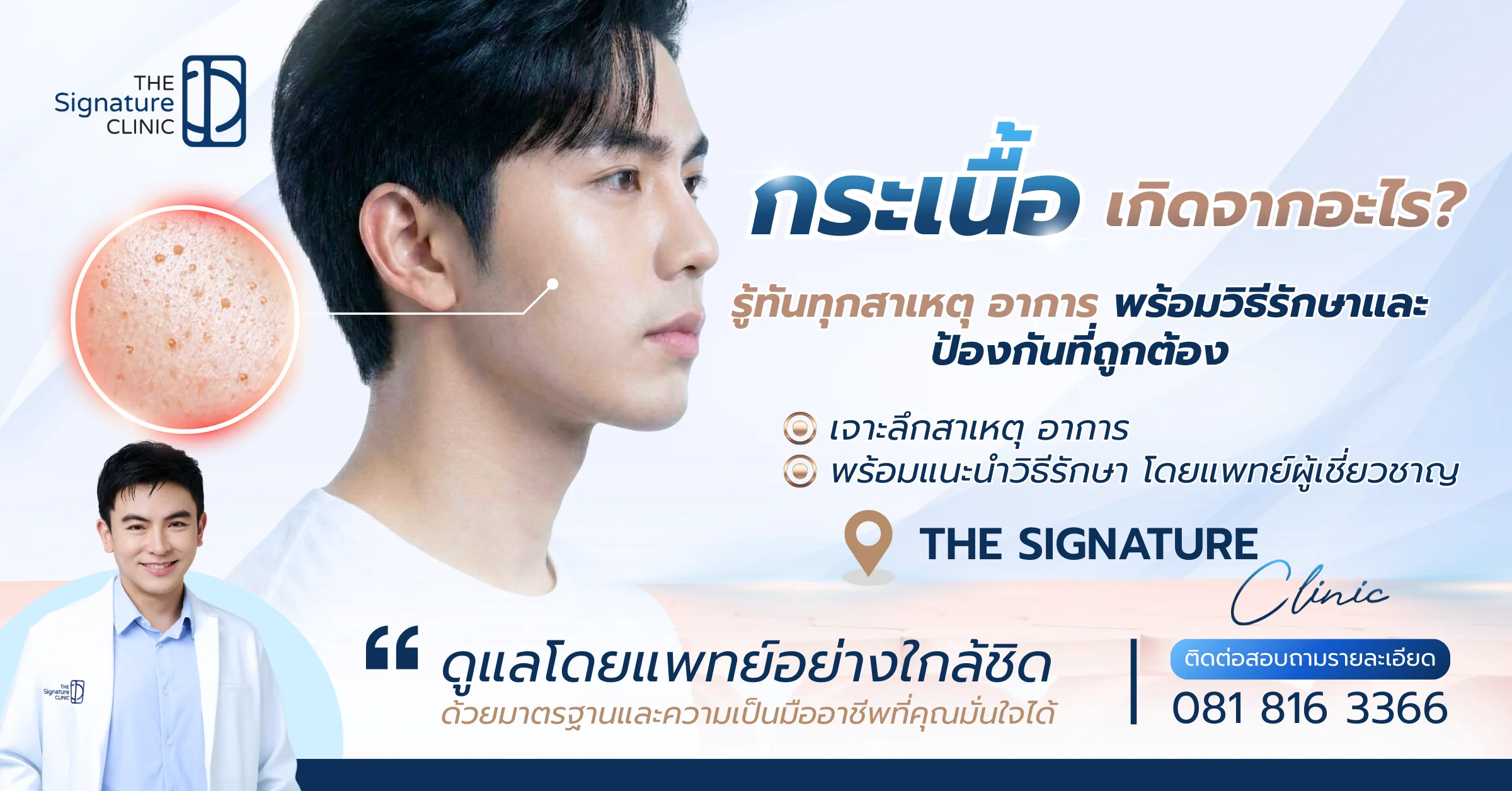 กระเนื้อเกิดจากอะไร 1