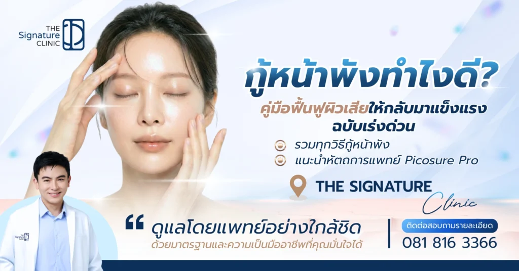 กู้หน้าพัง 1