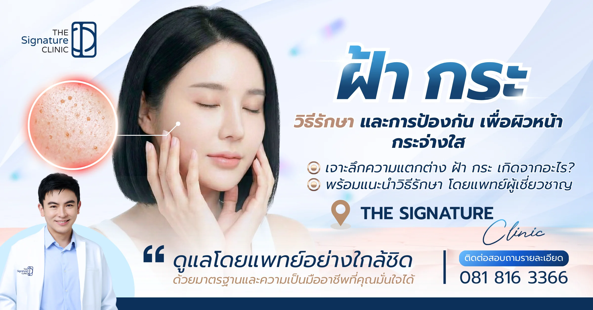 ฝ้า กระ 1