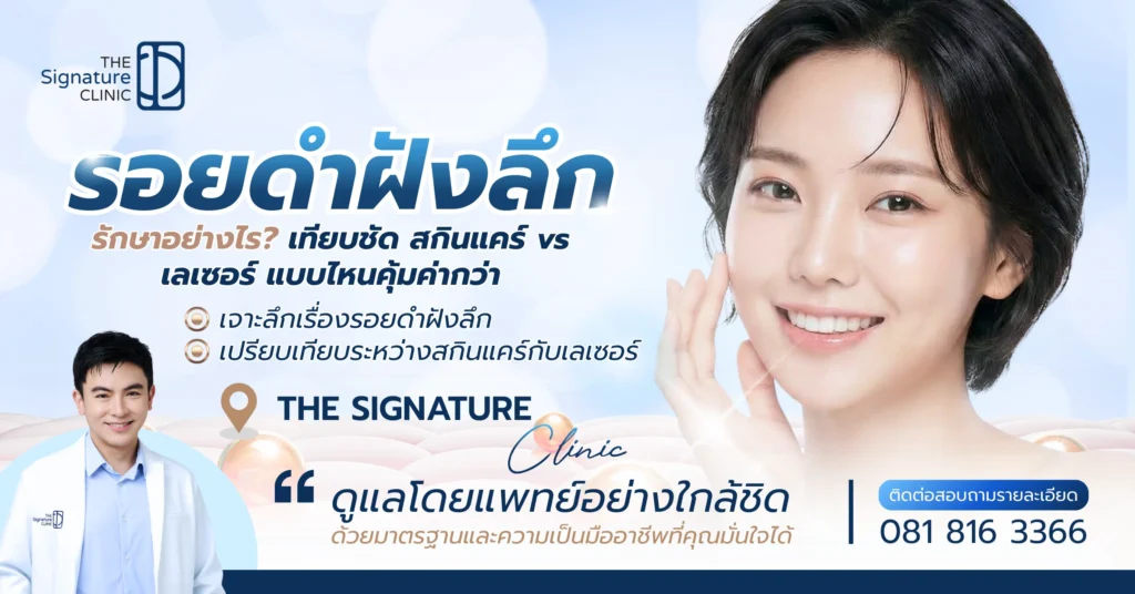 รอยดำฝังลึก 1