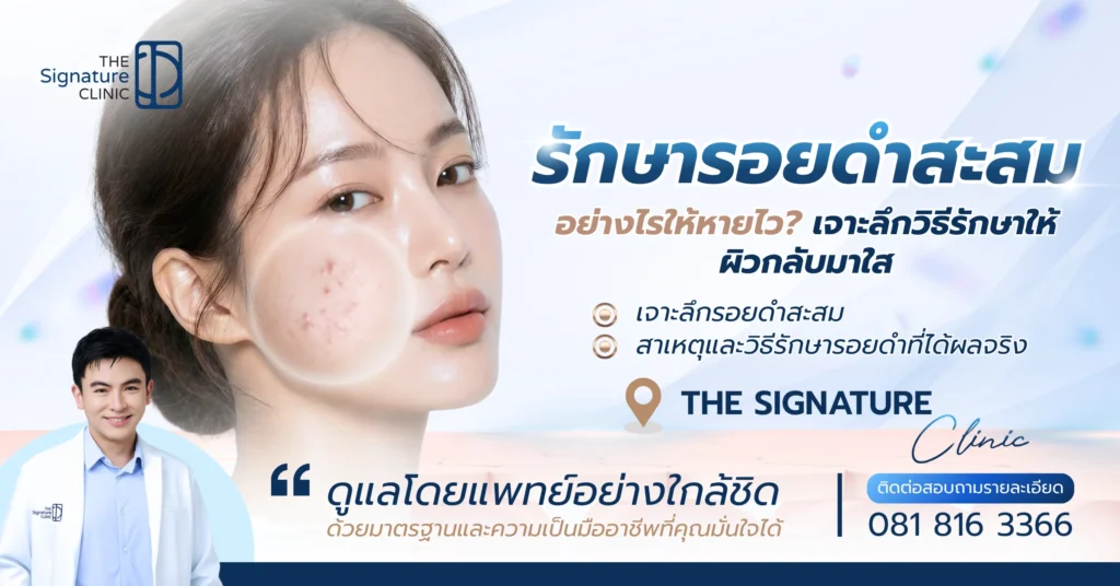 รอยดำสะสม 1