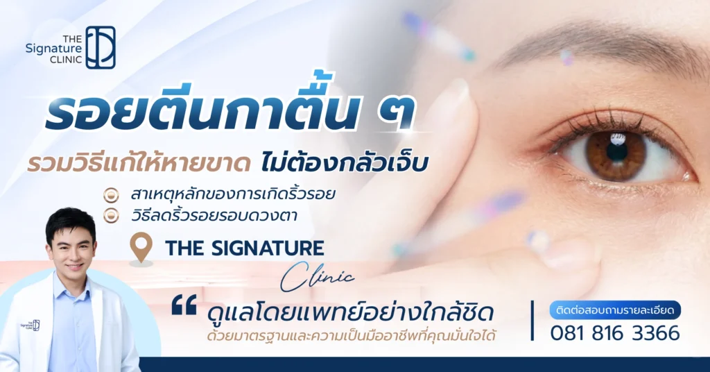 รอยตีนกาตื้น ๆ 1