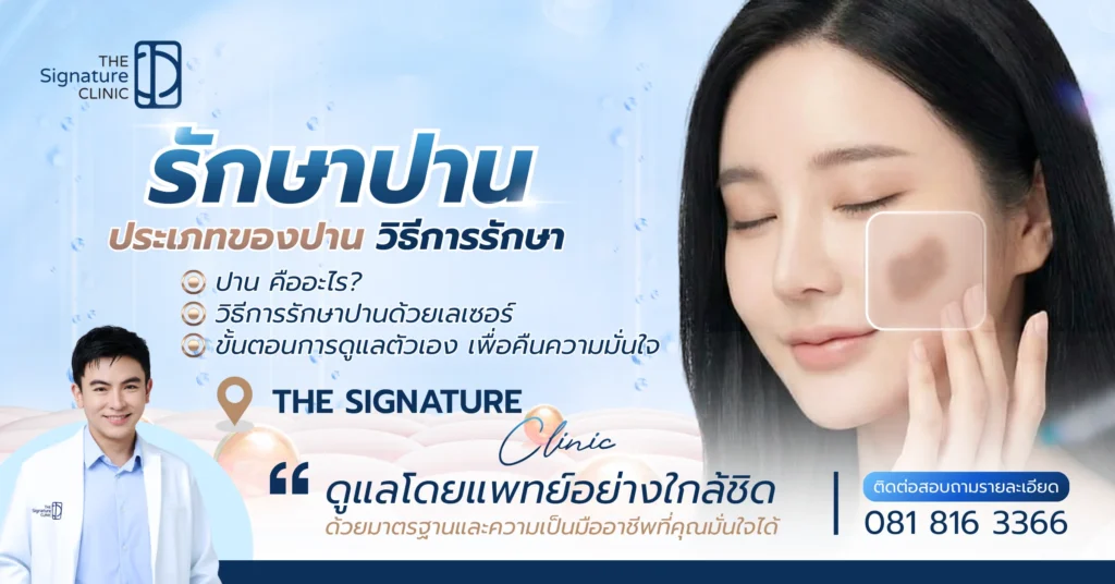 รักษาปาน 1