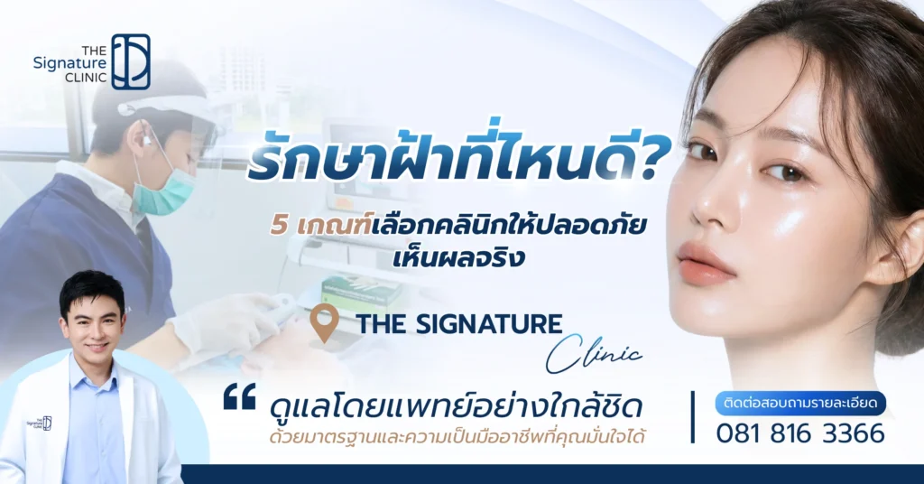 รักษาฝ้าที่ไหนดี 1