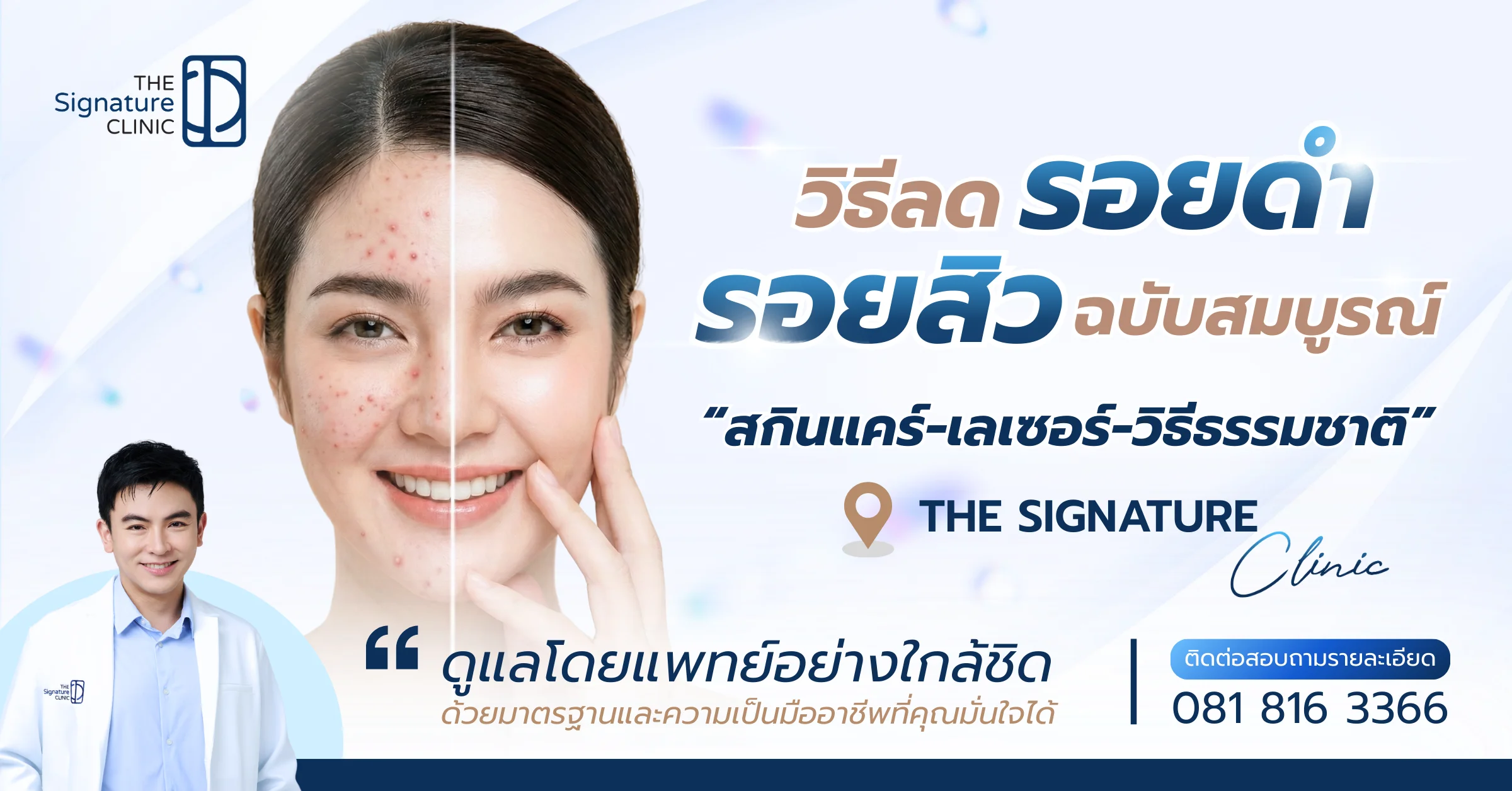 ลดรอยดำ 1