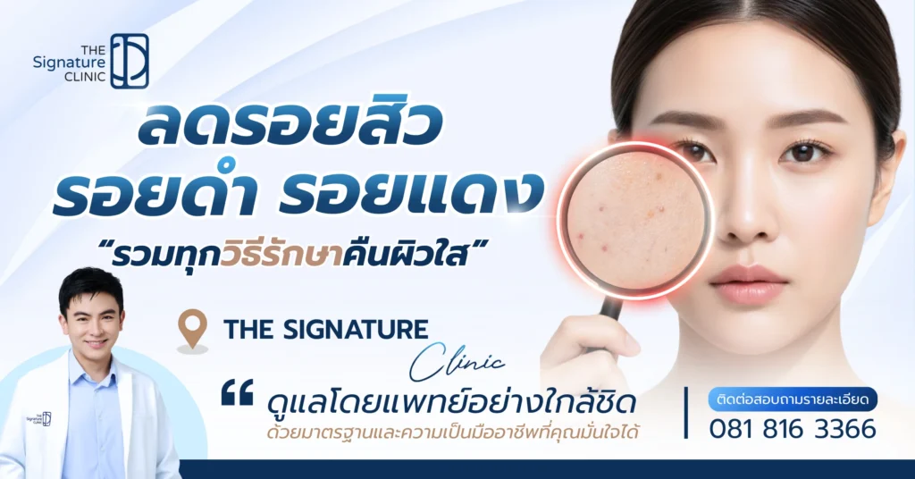 ลดรอยสิว รอยดํา รอยแดง 1